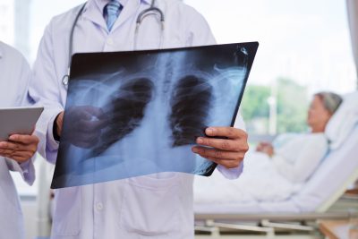 Pneumonia: here’s how you can prevent it